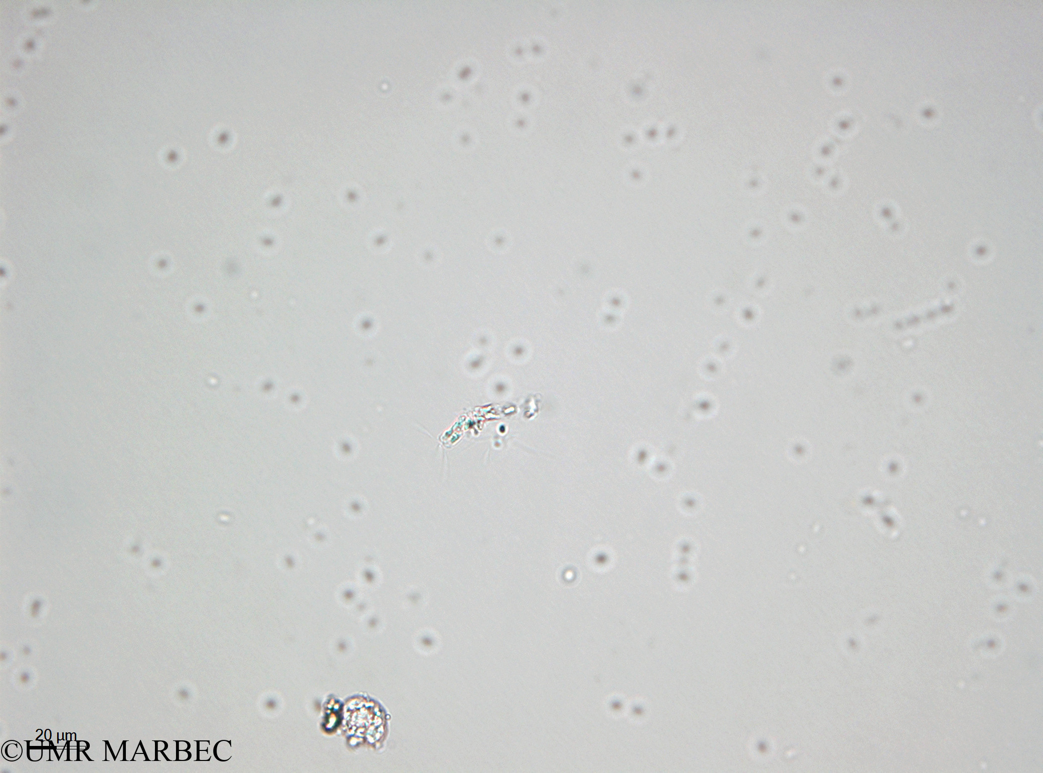 phyto/Bizerte/bizerte_bay/RISCO April 2014/Bacteriastrum sp4 (140728_001_ovl-3).tif(copy).jpg